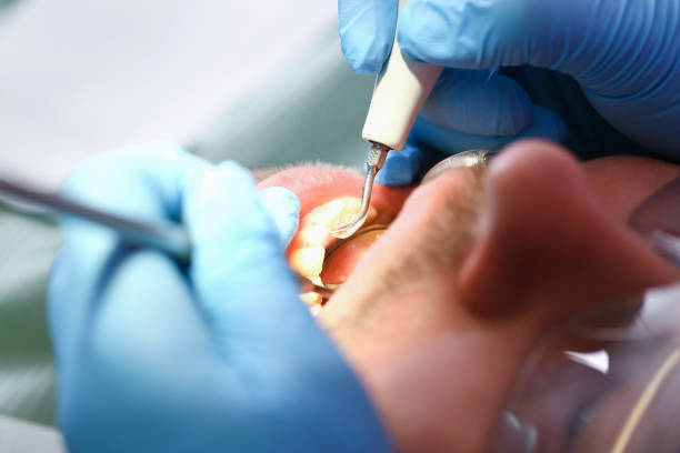 Best Root Canal Emergency Dentist  in Yreka, CA