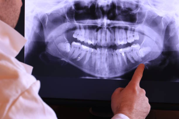 Best Emergency Dental Filling Replacement  in Yreka, CA