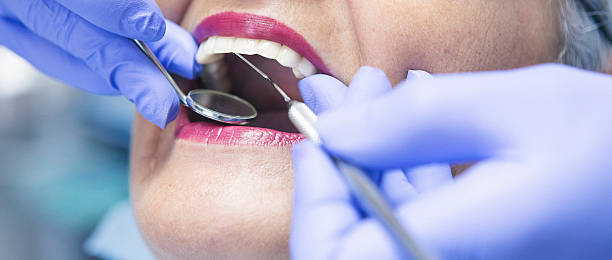 Best Tooth Infection Emergency Dentist  in Yreka, CA